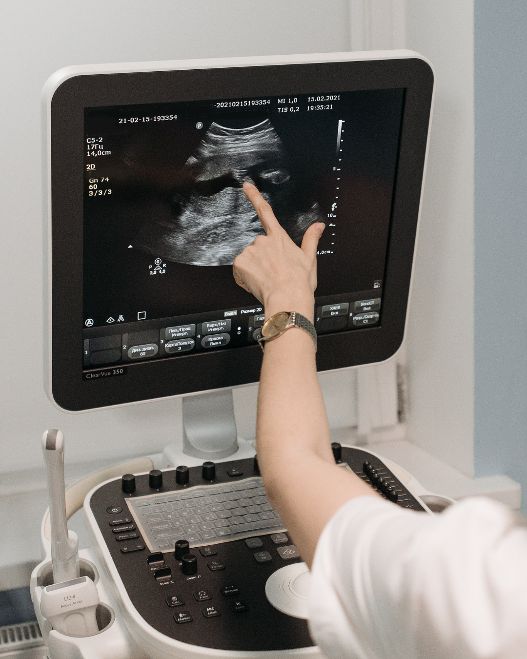 Private Ultrasound Scans in Surrey — Fast Answers You Can Trust